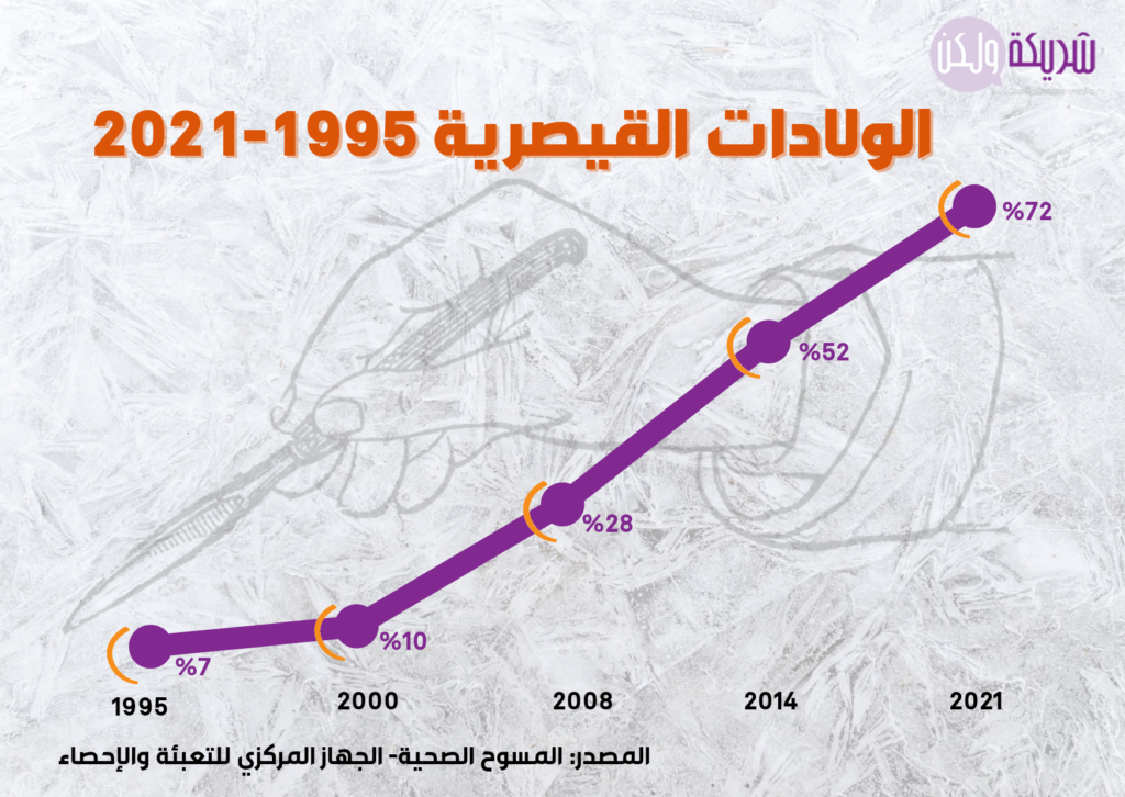 الولادات القيصرية