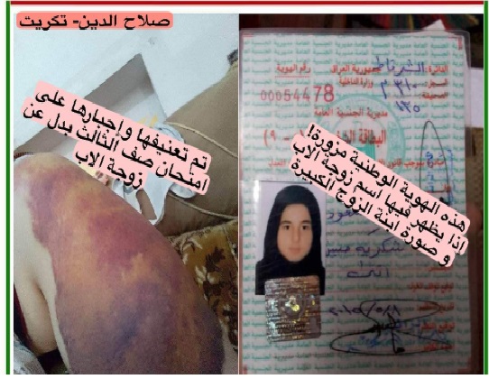 ستة أطفال في "تكريت" ضحايا العنف الأسري والتجويع