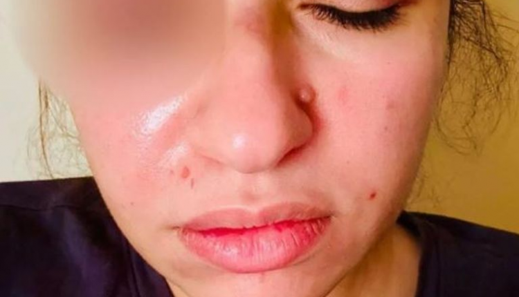 مصر: زوجة الفنان محمود حجازي تتهمه بالضرب والسحل أمام الجيران