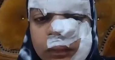 "مزق وجهها".. رجل يعتدي على زوجته بسبب دعوى خلع