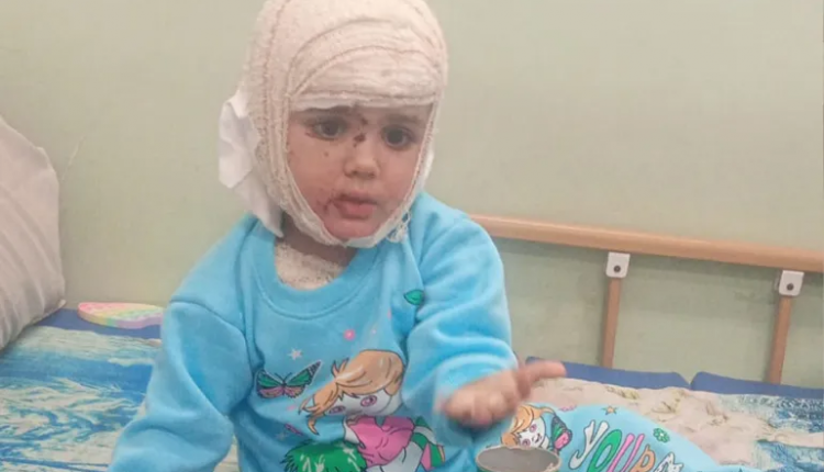 مناشدات عاجلة لإنقاذ الطفلة مسك ونقلها للعلاج خارج غزة